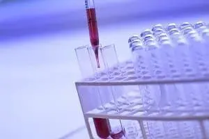 Adherent (formerly Compliance & Risks). A pipette dispenses red liquid into a test tube held in a lab rack.