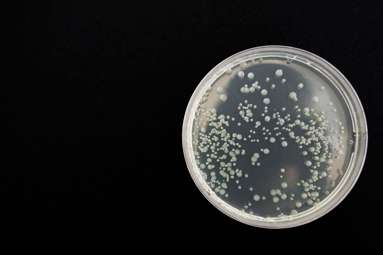 A clear petri dish filled with numerous white and off-white bacterial colonies on a black background.